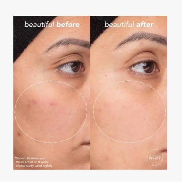 NWT, TULA Skincare, Bedtime Bright Vita-Charge Overnight Brightening Treatment - Picture 3 of 4